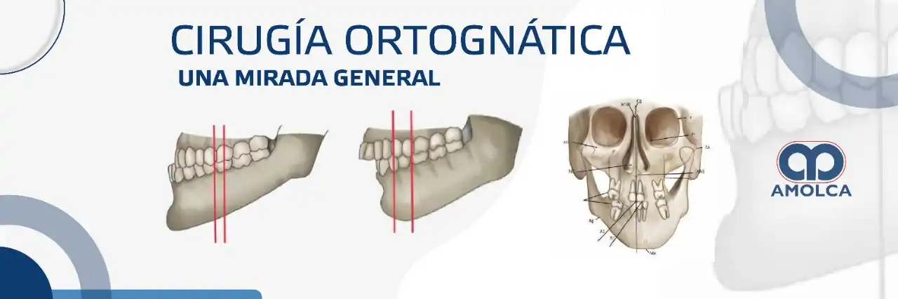 Cirugía Ortognática, una mirada general