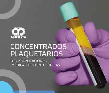 Concentrados plaquetarios y sus aplicaciones médicas y odontológicas