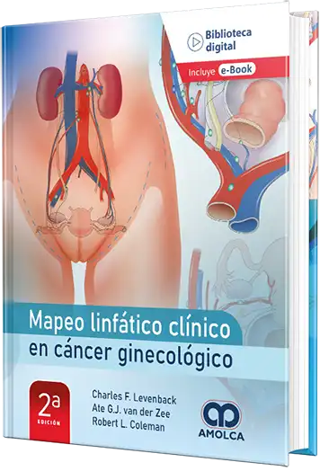 Mapeo linfático clínico en cáncer ginecológico