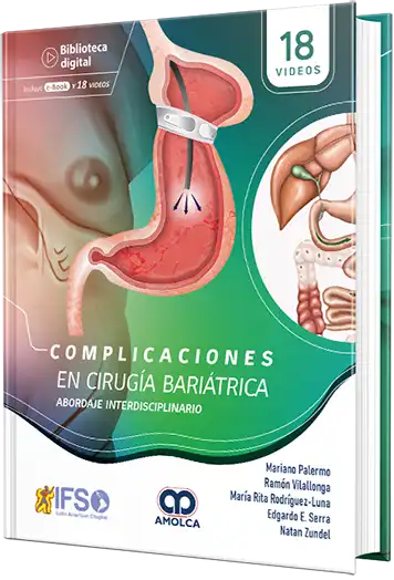 Complicaciones en Cirugía Bariátrica. Abordaje interdisciplinario.