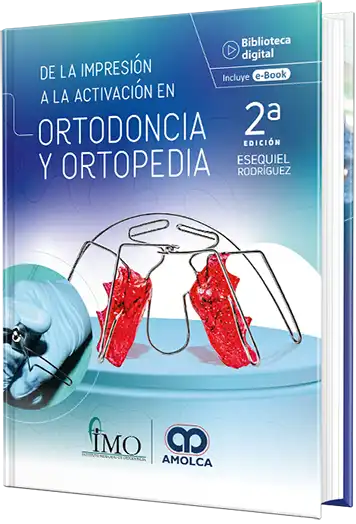 De la impresión a la activación en Ortodoncia y Ortopedia