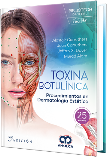 Toxina botulínica. Procedimientos en dermatología estética