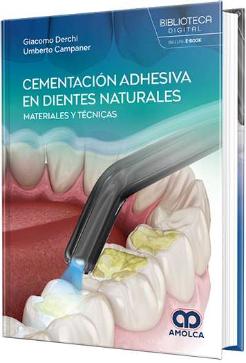 Cementación adhesiva en dientes naturales. Materiales y técnicas