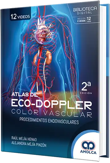 Atlas de Eco-doppler color vascular. Procedimientos endovasculares
