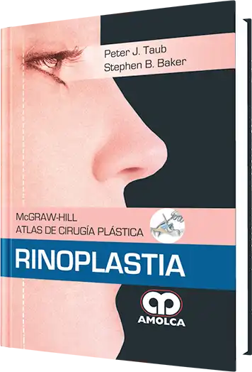 Atlas de Cirugía Plástica Rinoplastia