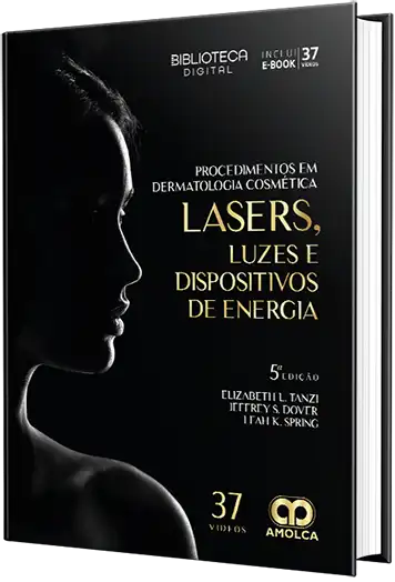 Lasers, luzes e dispositivos de energia. Procedimentos em Dermatologia Cosmética
