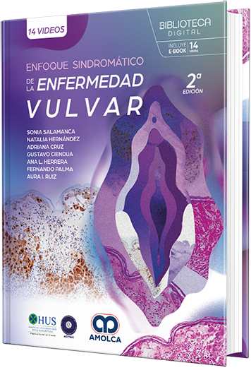 Enfoque sindromático de la enfermedad vulvar, 2.a edición