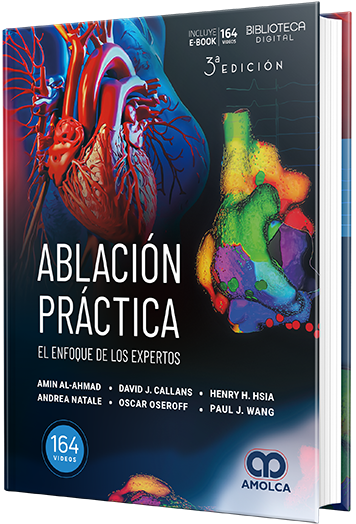 Ablación práctica. El enfoque de los expertos. 3ª Edición