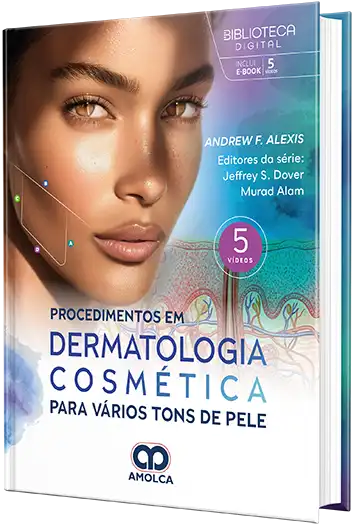 Procedimentos em dermatologia cosmética para vários tons de pele