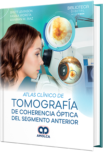 Atlas clínico de tomografía de coherencia óptica del segmento anterior