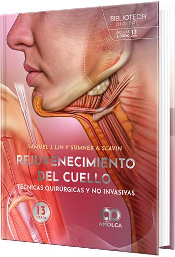 Rejuvenecimiento del cuello: Técnicas quirúrgicas y no invasivas