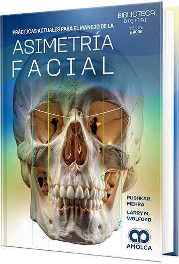 Prácticas actuales para el manejo de la asimetría facial