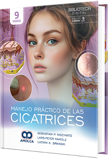 Manejo práctico de las cicatrices
