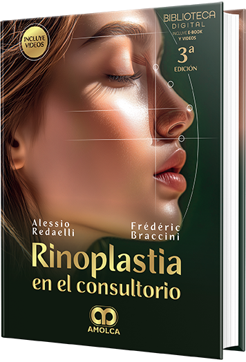 Rinoplastia en el consultorio