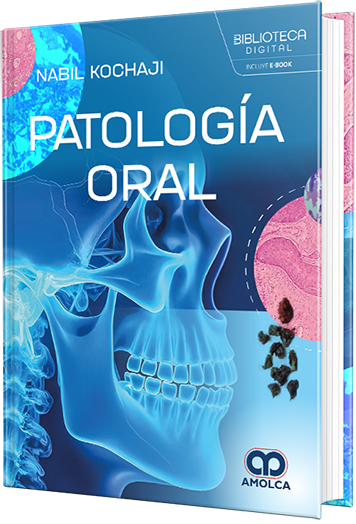 Patología oral