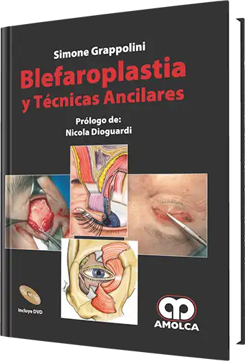 Blefaroplastia y Técnicas Ancilares