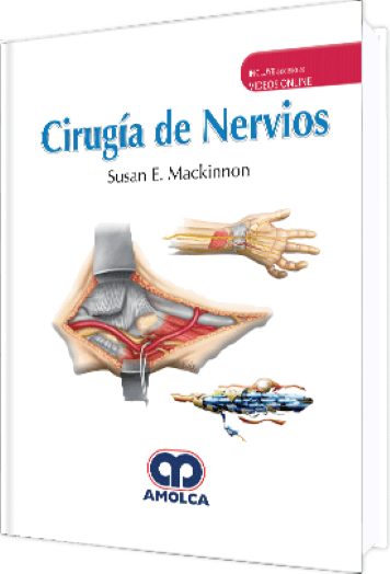 Cirugía de Nervios