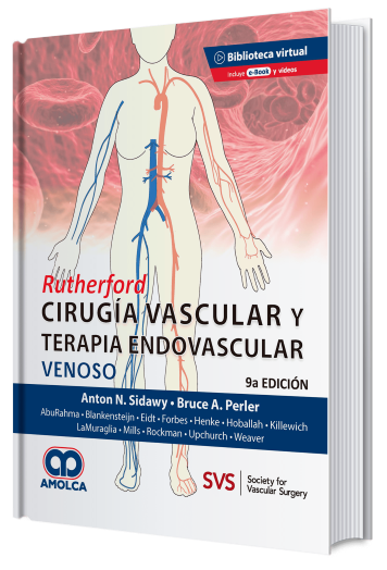Rutherford. Cirugía vascular y Terapia Endovascular. Venoso.  9 Edición