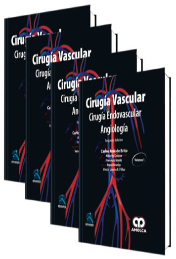 Cirugía Vascular. Cirugía Endovascular Angiología 2 Edición