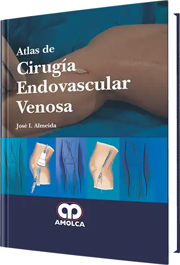 Atlas de Cirugía Endovascular Venosa