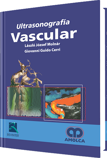 Ultrasonografía Vascular