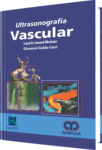 Ultrasonografía Vascular
