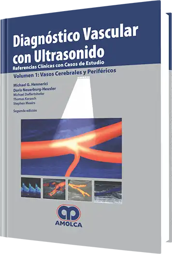 Diagnóstico Vascular con Ultrasonido. Volumen 1: Vasos Cerebrales 2 edición