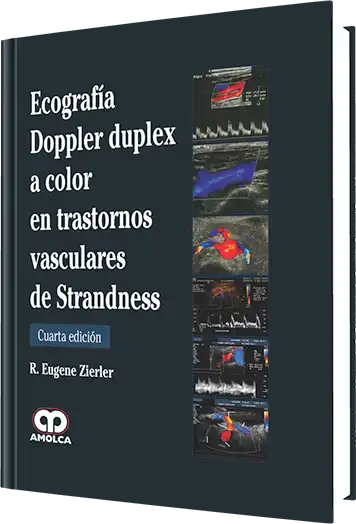 Ecografía Doppler Duplex a Color en Trastornos Vasculares de Strandness. 4 edición