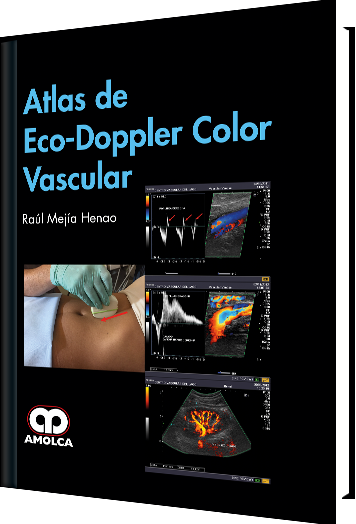 Atlas de Eco-Doppler Color Vascular