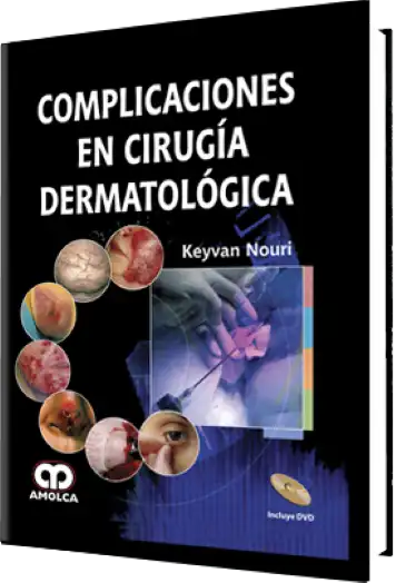 Complicaciones en Cirugía Dermatológica