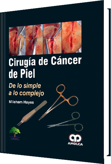 Cirugía de Cáncer de Piel