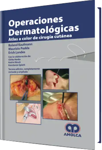 Operaciones Dermatológicas. Atlas a Color de Cirugía Cutánea 3 edición