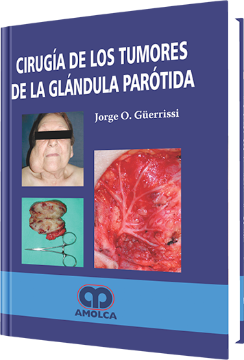 Cirugía de los Tumores de la Glándula Parótida