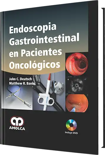Endoscopia Gastrointestinal en Pacientes Oncológicos