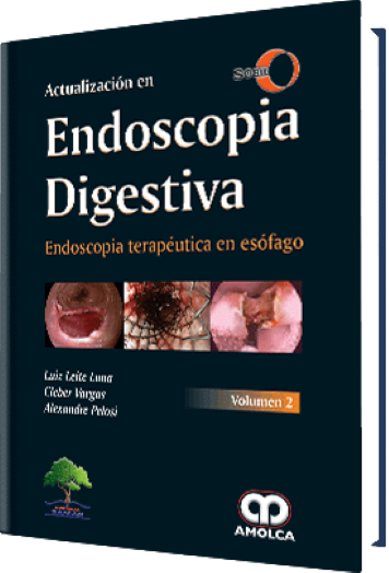 Actualización en Endoscopia Digestiva. Endoscopia Terapéutica en Esófago Volumen 2