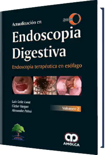 Actualización en Endoscopia Digestiva. Endoscopia Terapéutica en Esófago Volumen 2