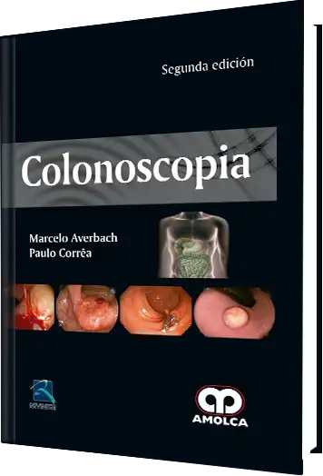 Colonoscopia 2 edición