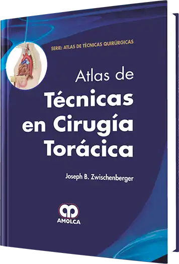 Atlas de Técnicas en Cirugía Torácica