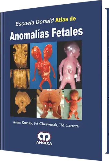 Escuela Donald  Atlas de Anomalías Fetales