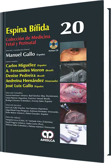 Espina Bífida. Volumen 20