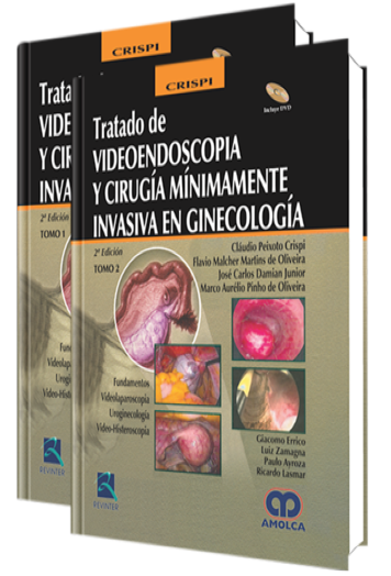 Tratado de Videoendoscopia y Cirugía Mínimamente Invasiva en Ginecología. 2 Edición