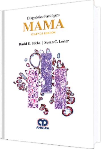 Diagnóstico Patológico Mama. 2 Edición