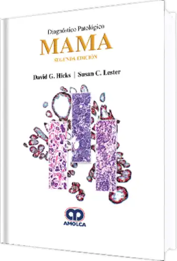 Diagnóstico Patológico Mama 2 edición