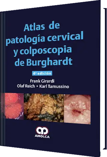Atlas de Patología Cervical y Colposcopia de Burghardt. 4 Edición