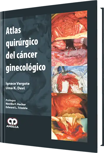 Atlas Quirúrgico del Cáncer Ginecológico