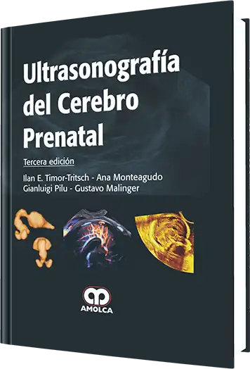 Ultrasonografía del Cerebro Prenatal. 3 edición