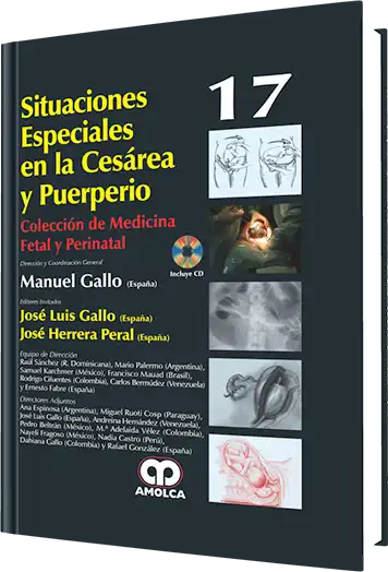 Situaciones Especiales en la Cesárea y Puerperio. Volumen 17