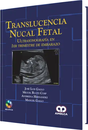 Translucencia Nucal Fetal
