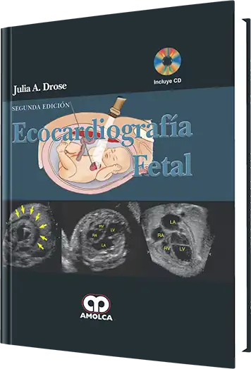 Ecocardiografía Fetal 2 edición
