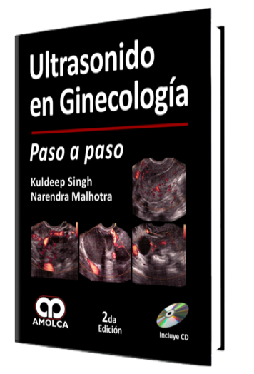 Ultrasonido en Ginecología Paso a paso. 2 Edición